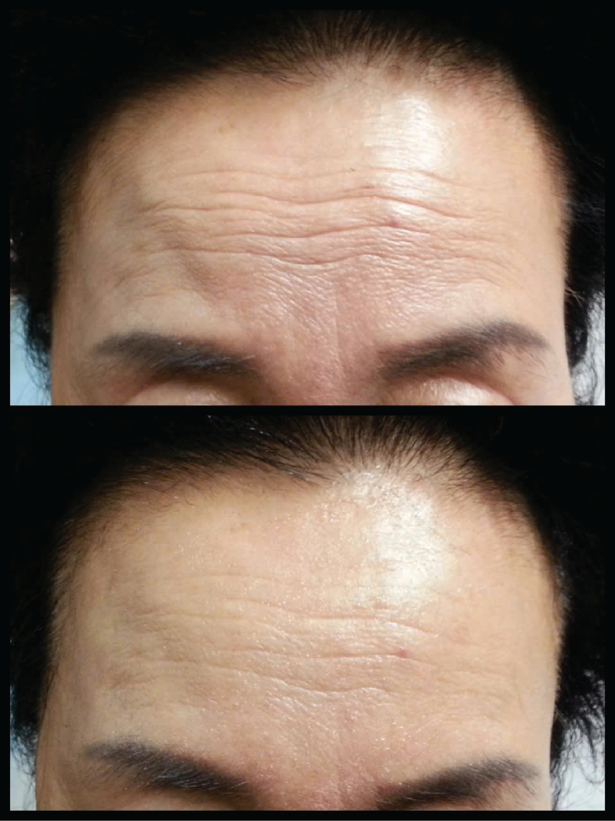 Before after 1