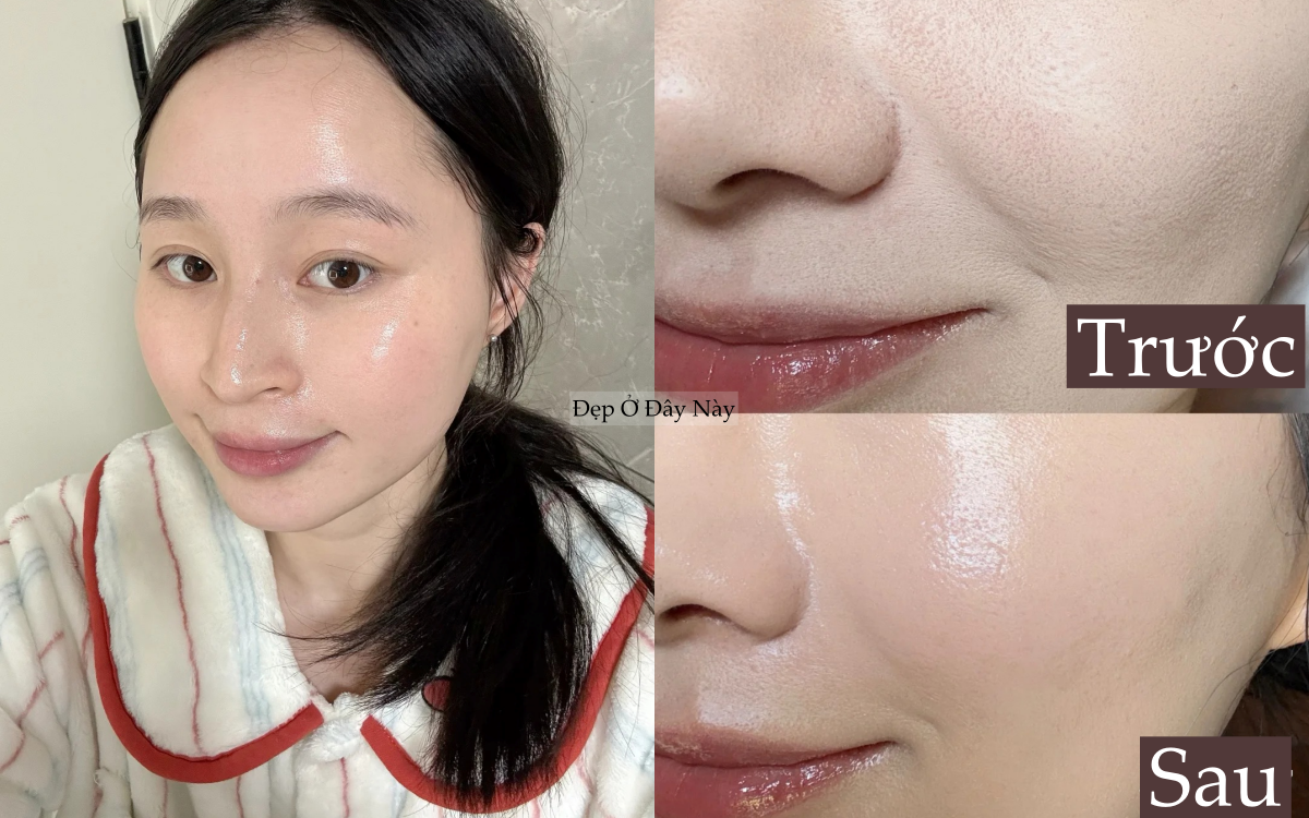 Before after 2