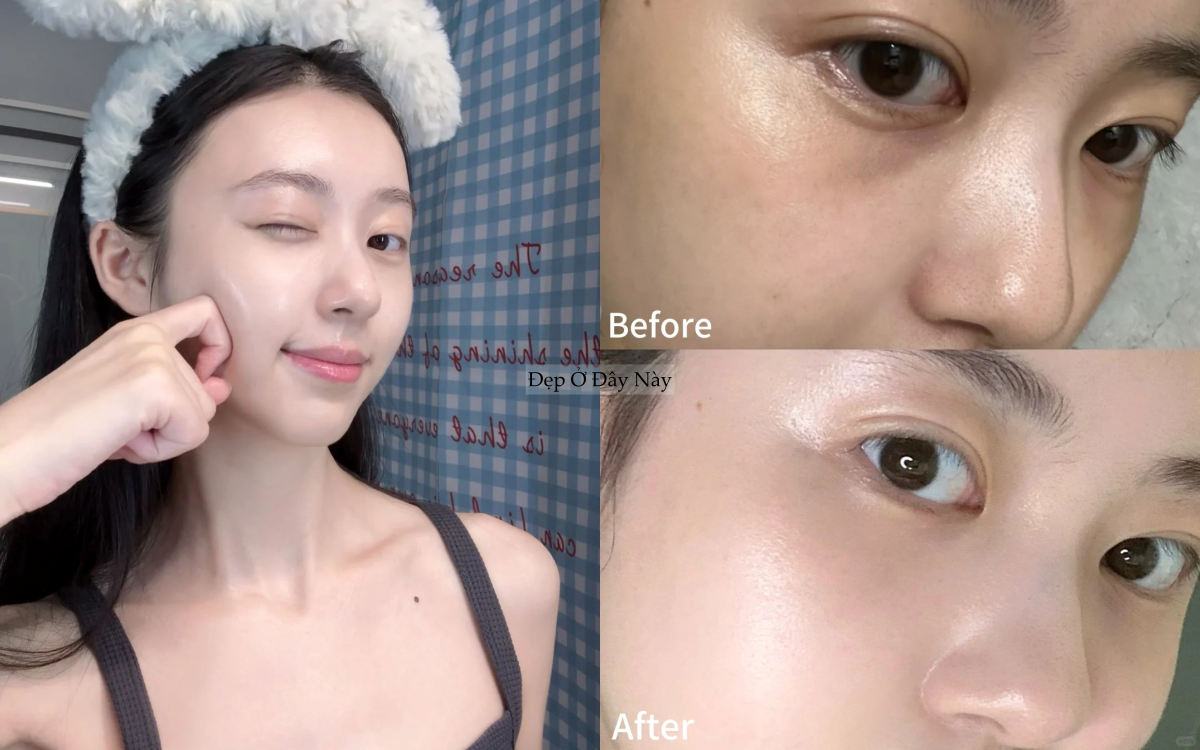 Before after 3